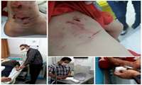 بروز9 مورد حیوان گزیدگی طی 24 ساعت گذشته در شهرستان پاکدشت   